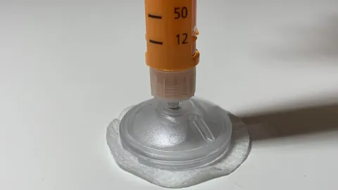 Hurtigvirkende insulin settes til måltidet.